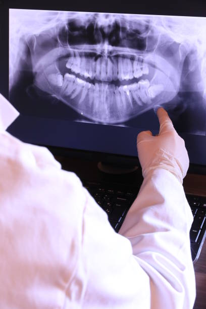 Best Emergency Denture Repair in Moorpark, CA